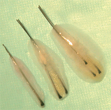 Single follicular hair transplantation