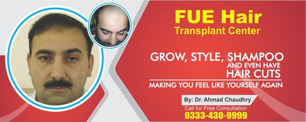 Hair restoration in Pakistan