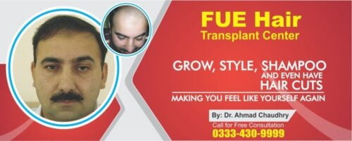 Hair restoration in Pakistan