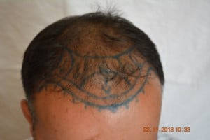 Hair treatment Burewala