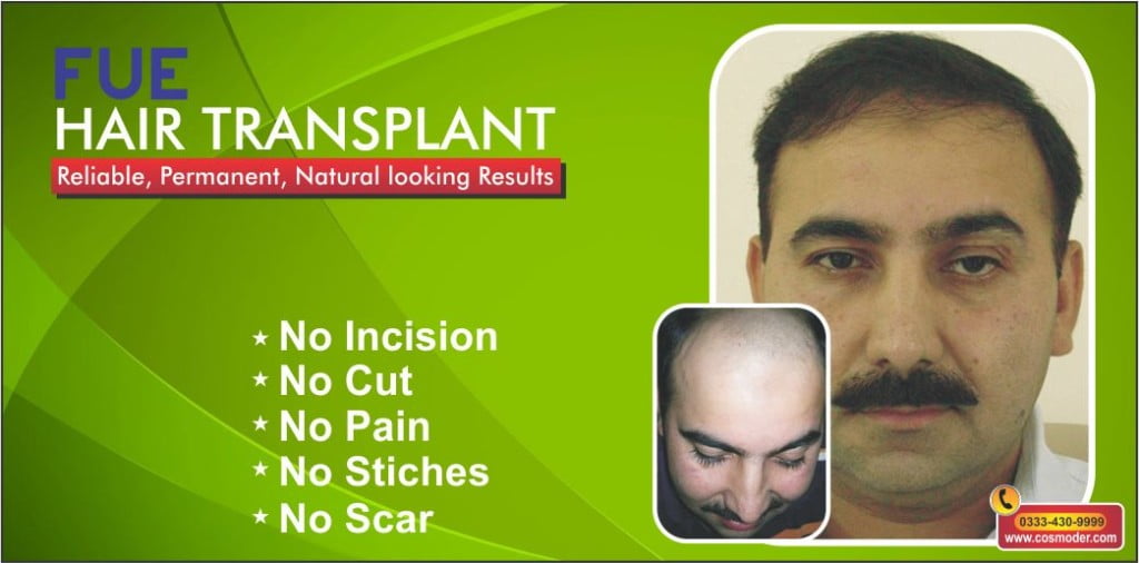 Male hair loss Lahore