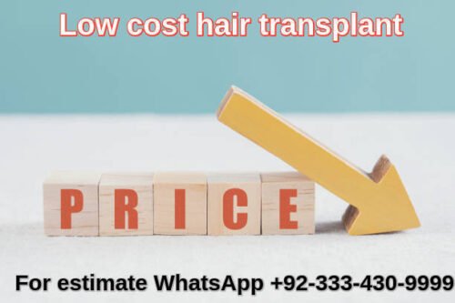 Total cost hair transplant laser Lahore