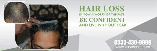 Hair transplant in Pakistan