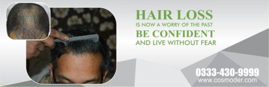 Hair Transplant in Pakistan