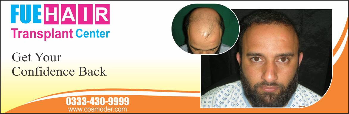 Hair transplant in Lahore