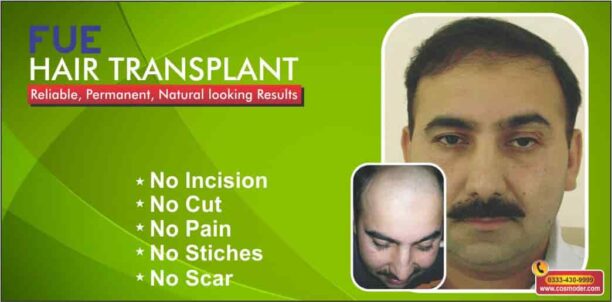 Male-hair-loss-Lahore-min