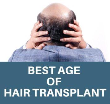 Which Age is best for Hair Transplant