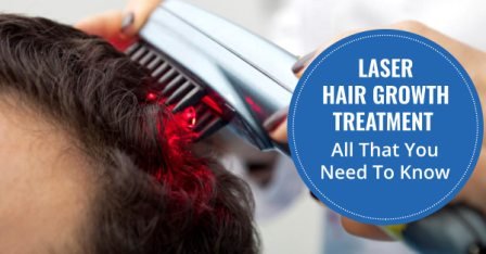 laser hair loss treatment Lahore