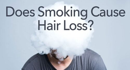 Does smoking cause hair loss