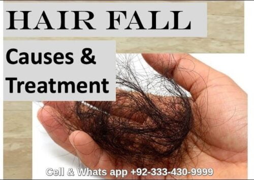 Hair fall solution Lahore
