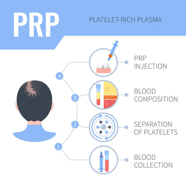 Basic platelet rich plasma technique