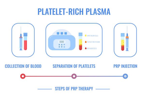 PRP treatment steps