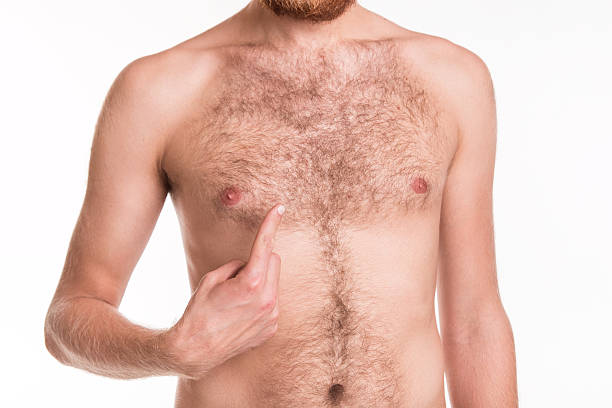 Body hair transplant Lahore Pakistan