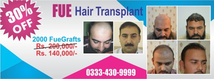 Hair surgery cost Pakistan