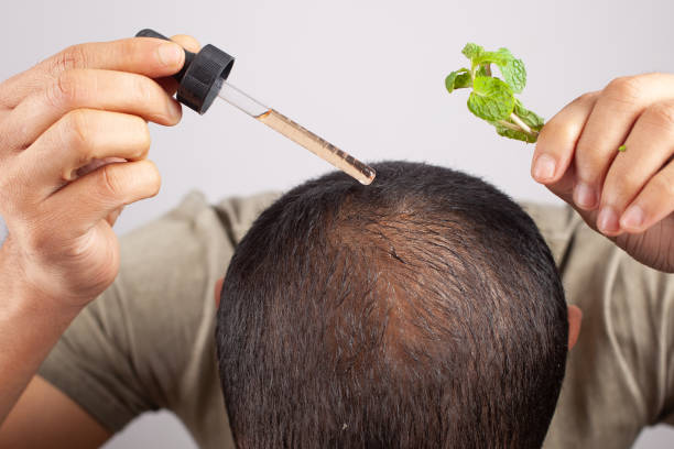 Hair oil for hair loss prevention Lahore