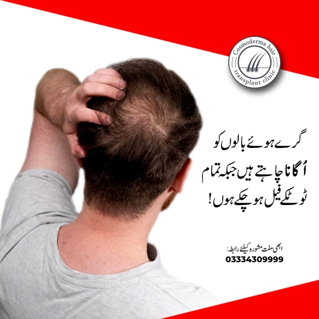 How to stop male pattern baldness